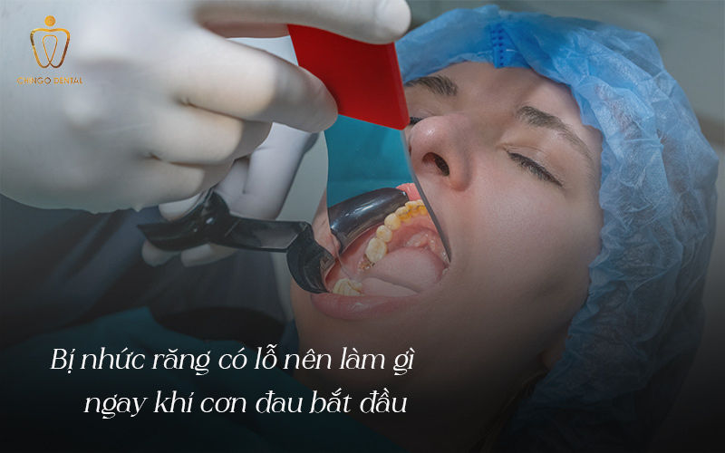 Cách Trị Nhức Răng Có Lỗ: Giảm Đau Nhanh Tại Nhà Và Biết Khi Nào Cần Gặp Nha Sĩ 6 cách trị đau răng