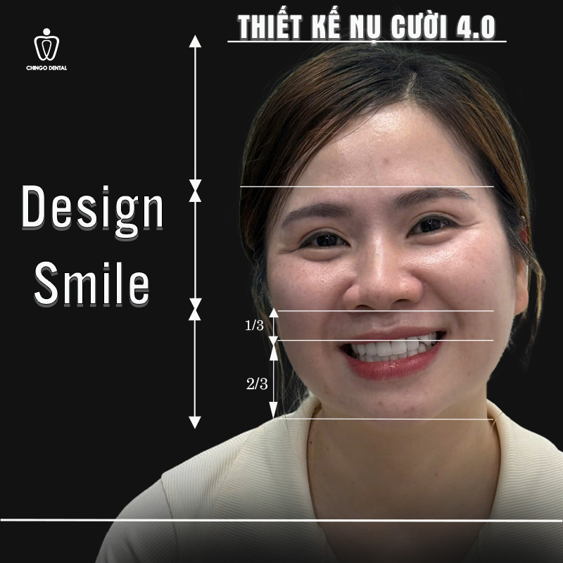 Răng Đẹp Là Như Thế Nào? 6 Tiêu Chuẩn Hàm Răng Đẹp Tự Nhiên Bạn Cần Biết 6 hàm răng đẹp chuẩn