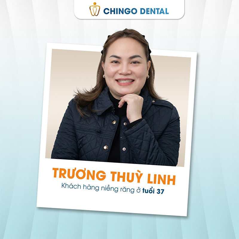 Trương Thùy Linh niềng răng