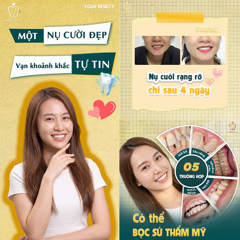 nha khoa uy tín tại đà nẵng