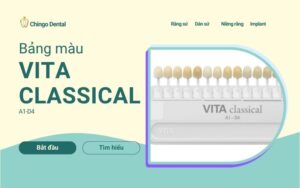 Bảng màu răng sứ thẩm mỹ: Kinh nghiệm chọn màu đẹp tự nhiên, không bị lố 2 Bảng màu răng sứ