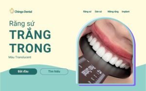 Bảng màu răng sứ thẩm mỹ: Kinh nghiệm chọn màu đẹp tự nhiên, không bị lố 5 Bảng màu răng sứ