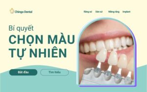 Bảng màu răng sứ thẩm mỹ: Kinh nghiệm chọn màu đẹp tự nhiên, không bị lố 7 Bảng màu răng sứ