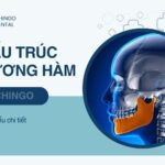 Xương Hàm Là Gì? Cấu Trúc Và Các Bệnh Lý Thường Gặp xương hàm