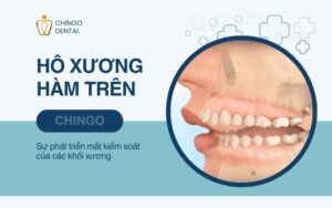 Xương Hàm Là Gì? Cấu Trúc Và Các Bệnh Lý Thường Gặp 5 xương hàm