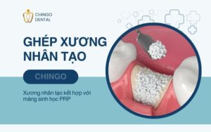 Xương Hàm Là Gì? Cấu Trúc Và Các Bệnh Lý Thường Gặp 6 xương hàm