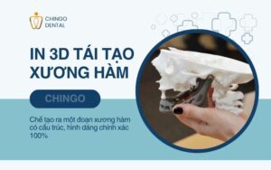 Xương Hàm Là Gì? Cấu Trúc Và Các Bệnh Lý Thường Gặp 7 xương hàm