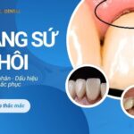 Chân Răng Sứ Bị Hôi - 5 Nguyên Nhân, Dấu Hiệu Và Cách Khắc Phục Triệt Để chân răng sứ bị hôi