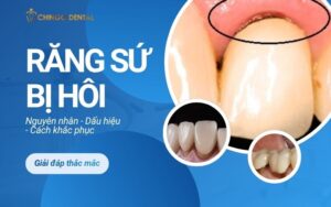 Chân răng sứ bị hôi - 5 nguyên nhân, dấu hiệu và cách khắc phục triệt để 1 chân răng sứ bị hôi