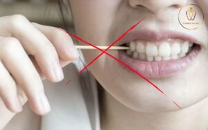 Chân răng sứ bị hôi - 5 nguyên nhân, dấu hiệu và cách khắc phục triệt để 4 chân răng sứ bị hôi