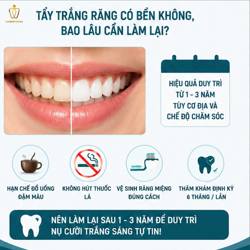 làm trắng răng bao nhiêu tiền

