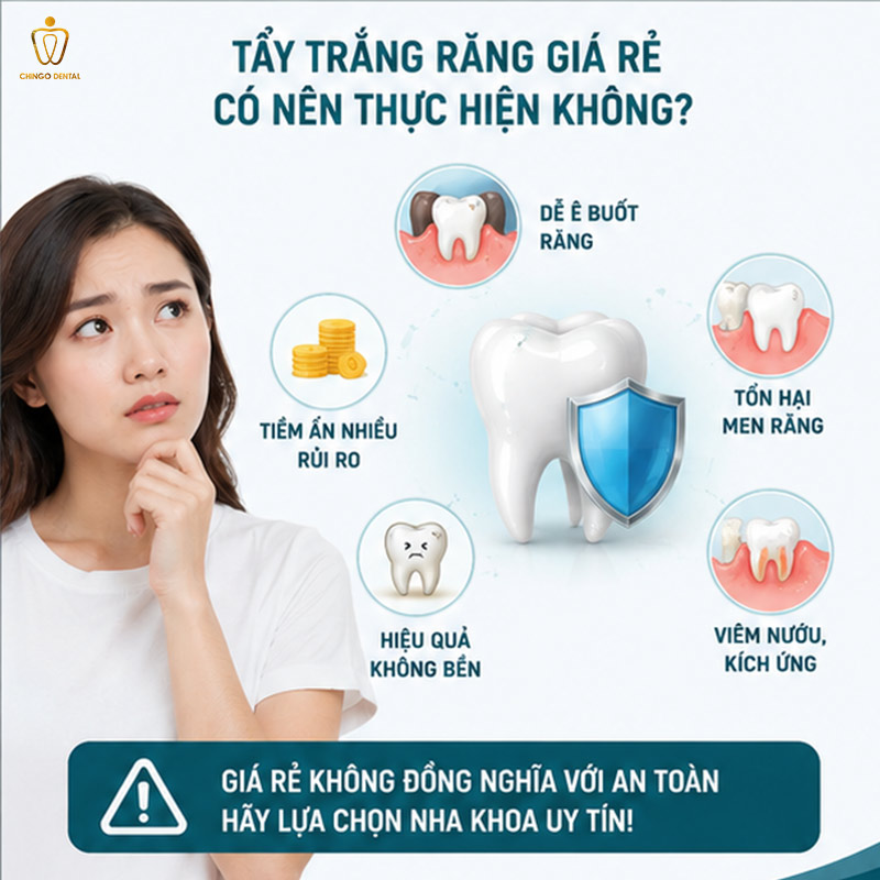 tẩy trắng răng bao nhiêu