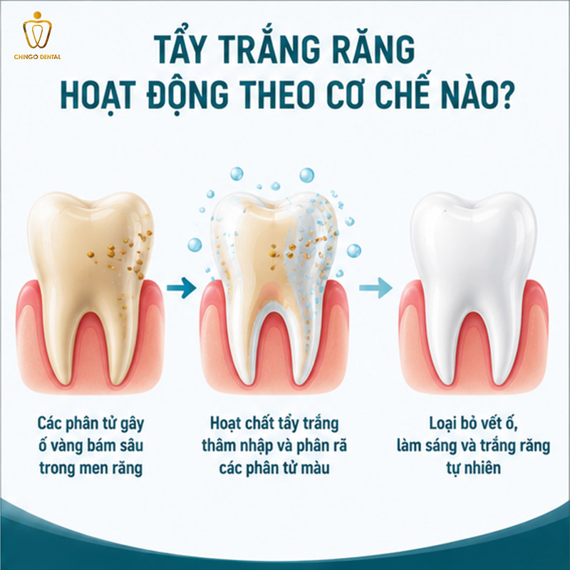 tẩy trắng răng có hại không