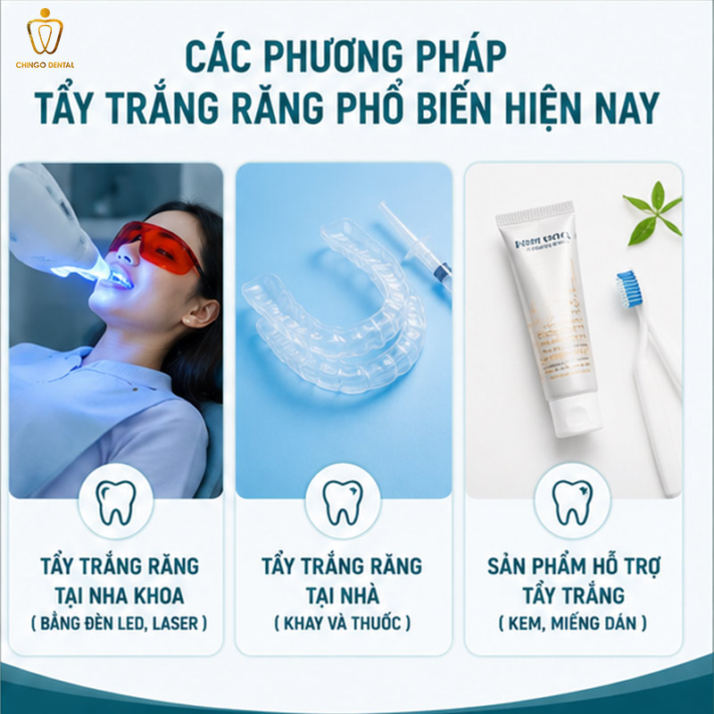 tẩy trắng răng được bao lâu
