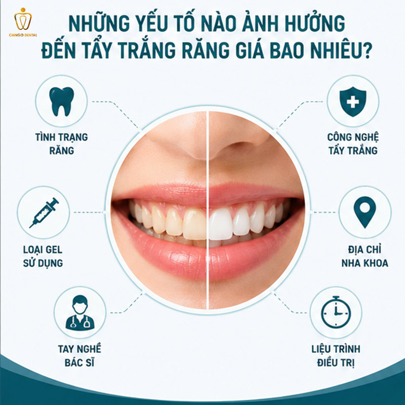 tẩy trắng răng giá bao nhiêu