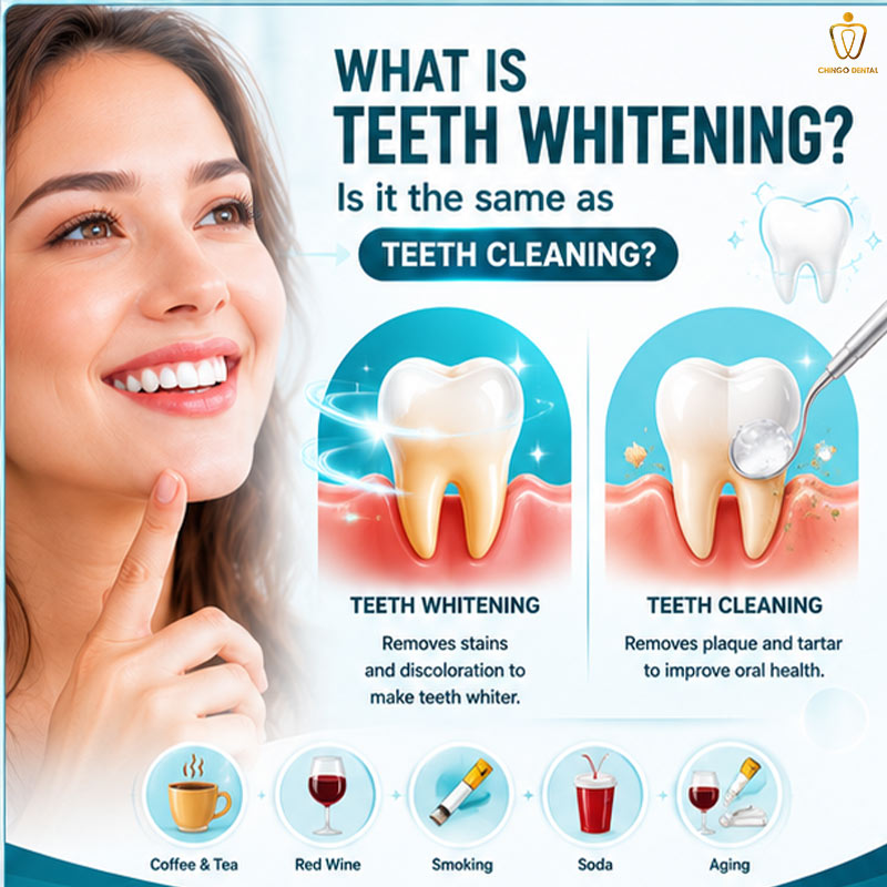 Teeth Whitening in Vietnam: Your Complete Guide to a Brighter, Confident Smile 1 teeth whitening