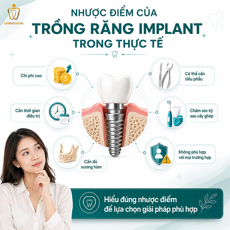 Nhược Điểm Của Trồng Răng Implant: Sự Thật Mà Bác Sĩ Cần Bạn Biết Trước Khi Quyết Định 3 có nên trồng răng implant không