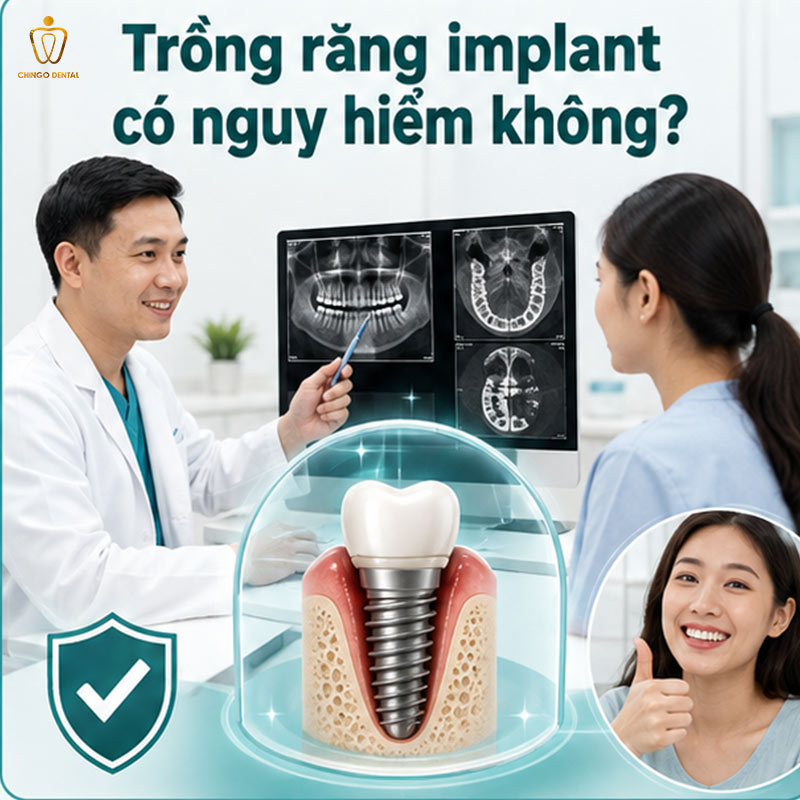 Hối Hận Khi Trồng Implant: Nguyên Nhân Thực Sự Và Cách Không Phải Trải Qua Điều Đó 4 hậu quả của việc cắm trụ implant