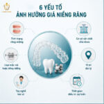 Yếu Tố Ảnh Hưởng Giá Niềng Răng: Tại Sao Cùng Một Phương Pháp Mà Giá Lại Chênh Nhau Đến Vậy? niềng răng bao nhiêu tiền
