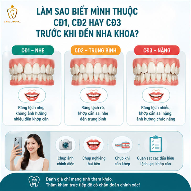 Yếu Tố Ảnh Hưởng Giá Niềng Răng: Tại Sao Cùng Một Phương Pháp Mà Giá Lại Chênh Nhau Đến Vậy? 4 niềng răng chi phí bao nhiêu
