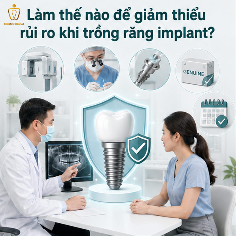 Nhược Điểm Của Trồng Răng Implant: Sự Thật Mà Bác Sĩ Cần Bạn Biết Trước Khi Quyết Định 4 review trồng răng implant