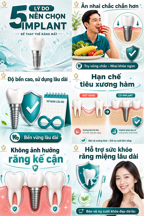 Hối Hận Khi Trồng Implant: Nguyên Nhân Thực Sự Và Cách Không Phải Trải Qua Điều Đó 5 tác dụng phụ của trồng răng implant