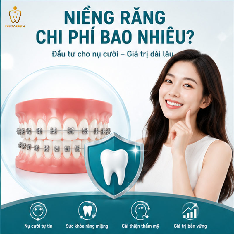 Yếu Tố Ảnh Hưởng Giá Niềng Răng: Tại Sao Cùng Một Phương Pháp Mà Giá Lại Chênh Nhau Đến Vậy? 1 yếu tố ảnh hưởng giá niềng răng
