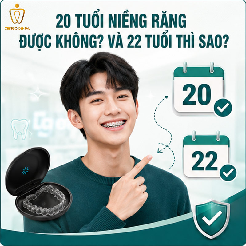 20 Tuổi Niềng Răng Bao Nhiêu Tiền? Bảng Giá & Giải Đáp Toàn Diện 1 20 tuổi niềng răng bao nhiêu tiền