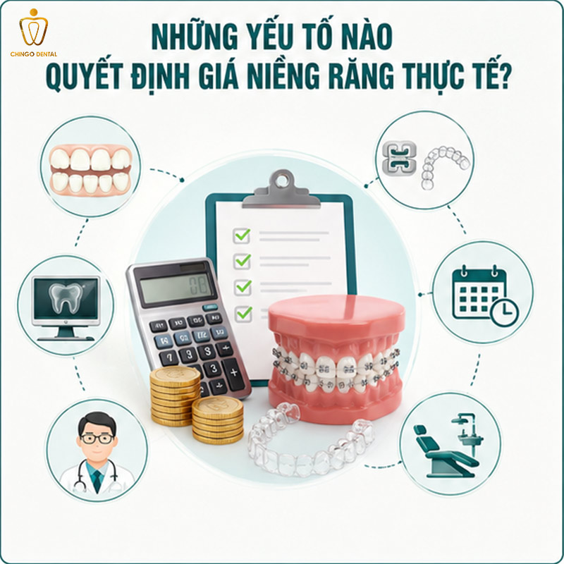 20 Tuổi Niềng Răng Bao Nhiêu Tiền? Bảng Giá & Giải Đáp Toàn Diện 3 22 tuổi niềng răng được không