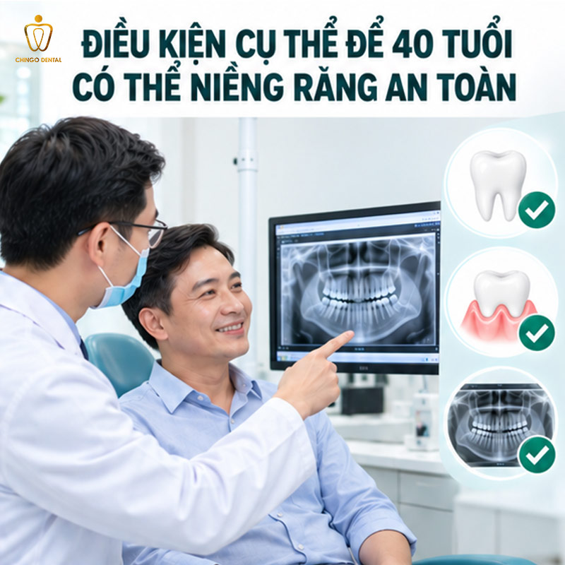 40 Tuổi Có Niềng Răng Được Không? Câu Trả Lời Từ Chuyên Gia Chỉnh Nha 2 40 tuổi có nên niềng răng