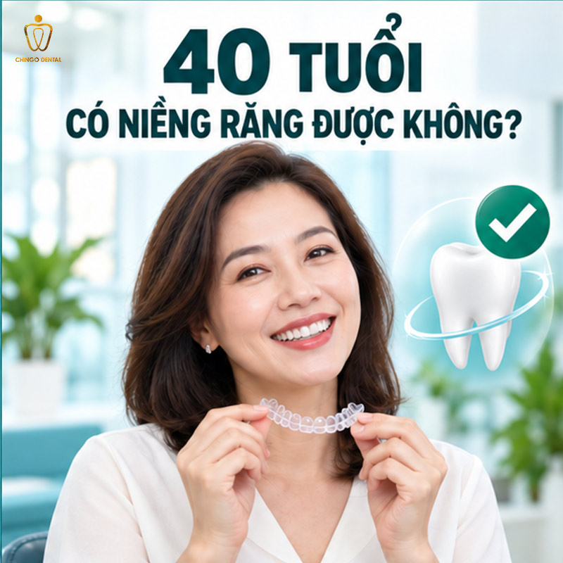 40 Tuổi Có Niềng Răng Được Không? Câu Trả Lời Từ Chuyên Gia Chỉnh Nha 1 40 tuổi có niềng răng được không