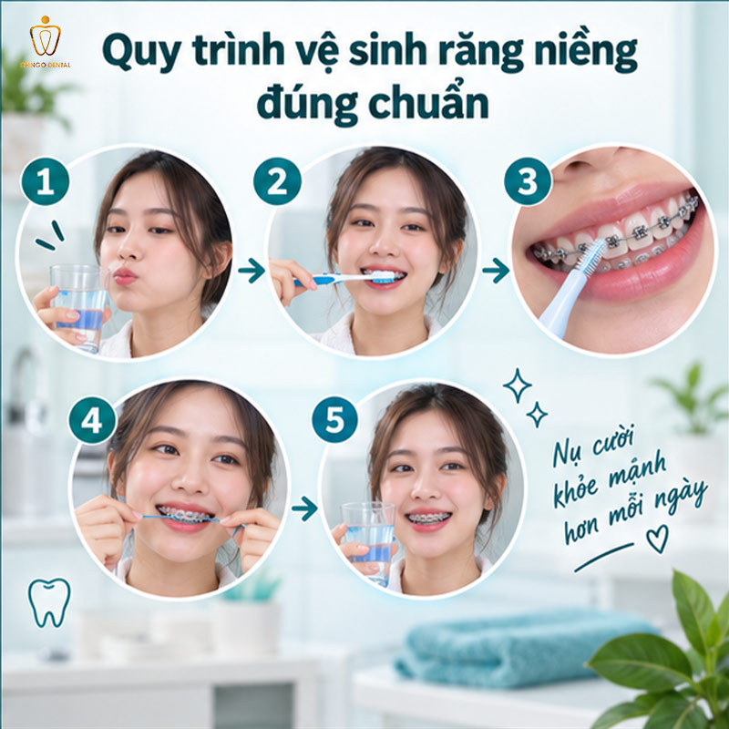 Bàn Chải Niềng Răng: Loại Nào Phù Hợp Và Cách Dùng Đúng Để Răng Luôn Sạch Trong Suốt Hành Trình Chỉnh Nha 4 bàn chải cho người niềng răng