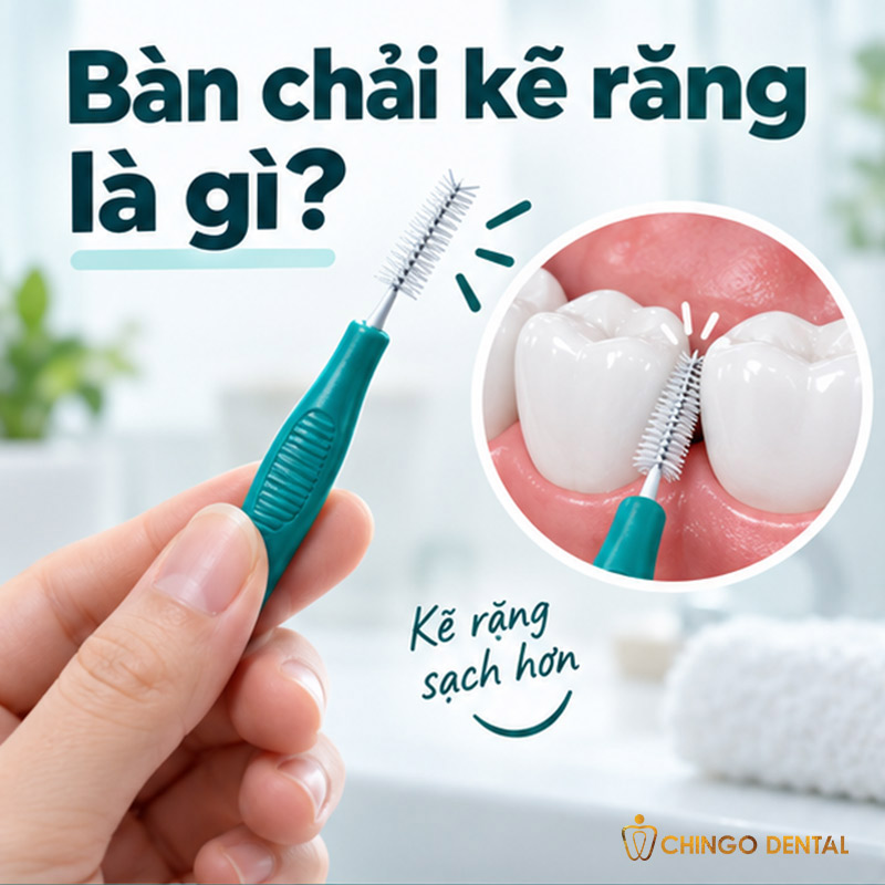 Bàn Chải Kẽ Răng Là Gì? Cách Dùng Đúng Và Lưu Ý Quan Trọng Cho Người Niềng 1 bàn chải kẽ răng là gì