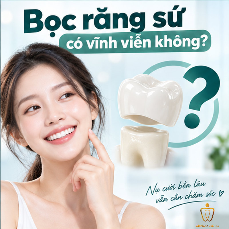 Bọc Răng Sứ Bao Lâu Thì Phải Làm Lại? Tuổi Thọ Thực Sự Và Những Điều Nha Khoa Ít Ai Nói Cho Bạn Biết 1 bọc răng sứ bao lâu thì phải làm lại