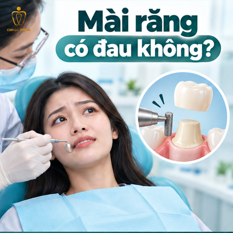 Bọc Răng Sứ Có Đau Không? Sự Thật Và Cảm Giác Thực Tế Bạn Cần Biết 1 bọc răng sứ có đau không