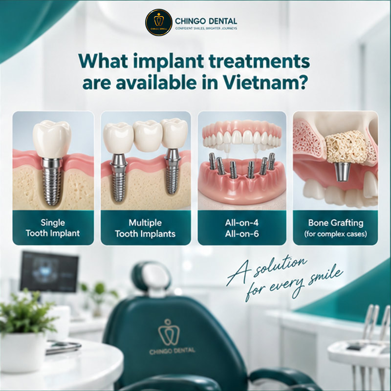 Dental Implants in Vietnam: Cost, Clinics & What Patients Need to Know 2 dental implants in vietnam
