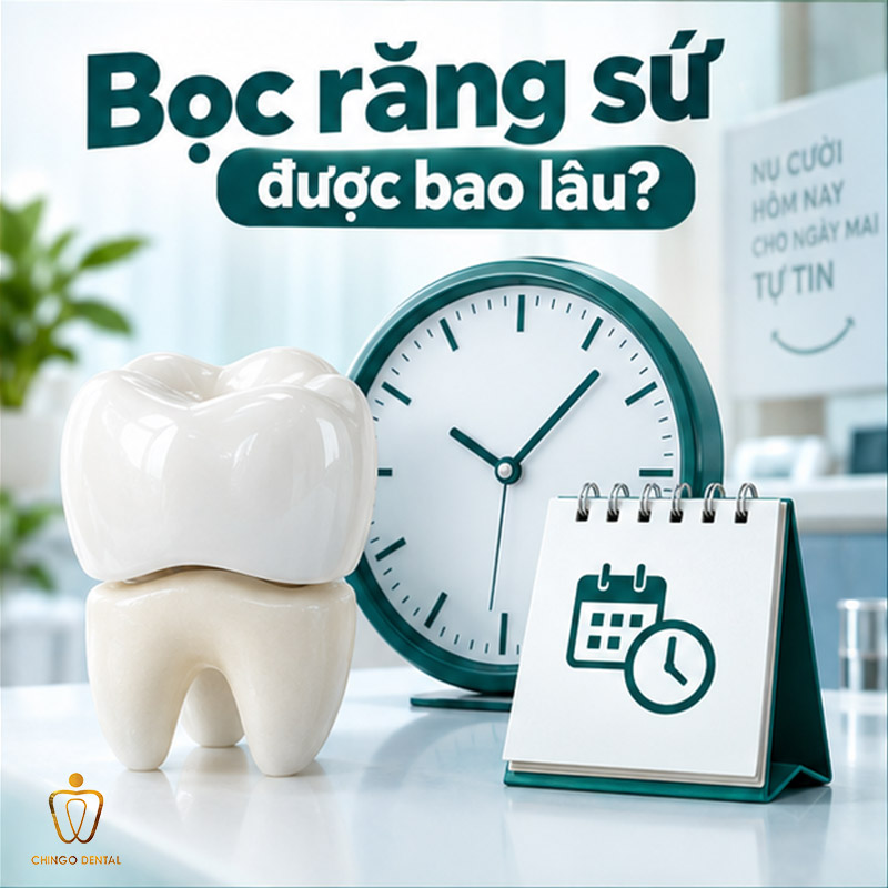 Bọc Răng Sứ Bao Lâu Thì Phải Làm Lại? Tuổi Thọ Thực Sự Và Những Điều Nha Khoa Ít Ai Nói Cho Bạn Biết 2 làm răng sứ mất bao lâu
