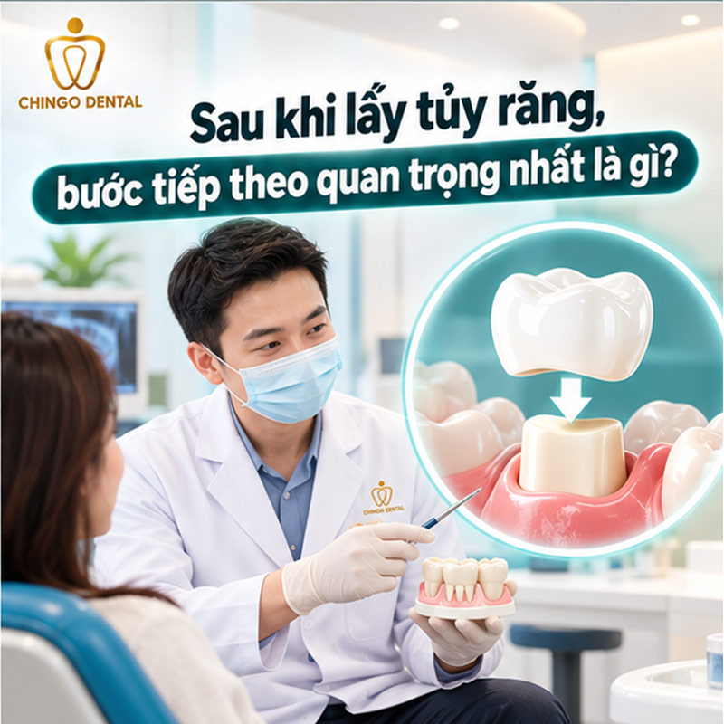 Triệu Chứng Sau Khi Lấy Tủy Răng: Bình Thường Hay Đáng Lo? Cách Xử Lý Đúng Ngay Tại Nhà 4 lấy tủy có đau không