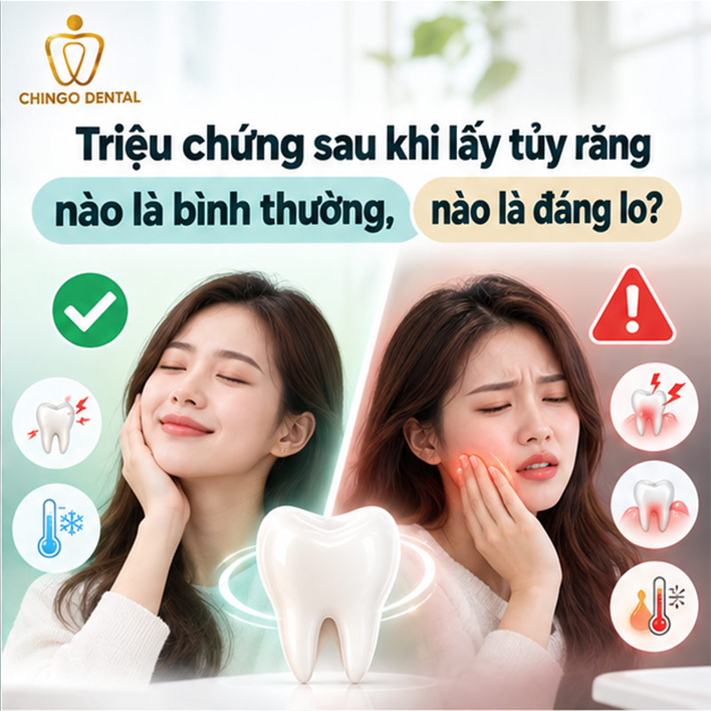 Triệu Chứng Sau Khi Lấy Tủy Răng: Bình Thường Hay Đáng Lo? Cách Xử Lý Đúng Ngay Tại Nhà 2 lấy tủy răng có đau không