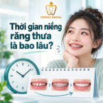 niềng răng thưa 1 hàm giá bao nhiêu