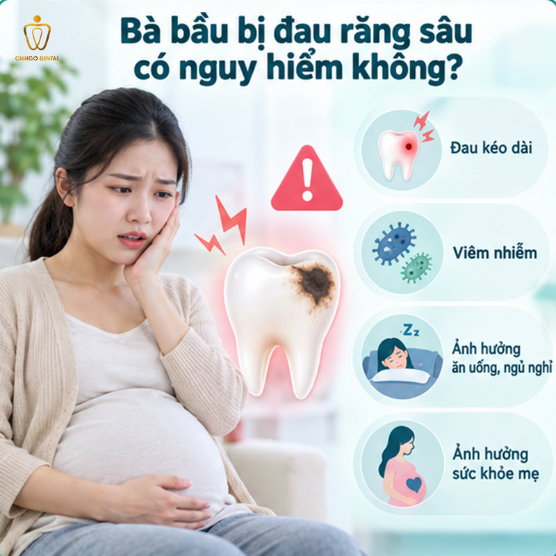 Bà Bầu Bị Đau Răng Sâu Phải Làm Sao? Cách Xử Lý An Toàn Cho Mẹ & Bé 2 thuốc đặc trị sâu răng cho bà bầu