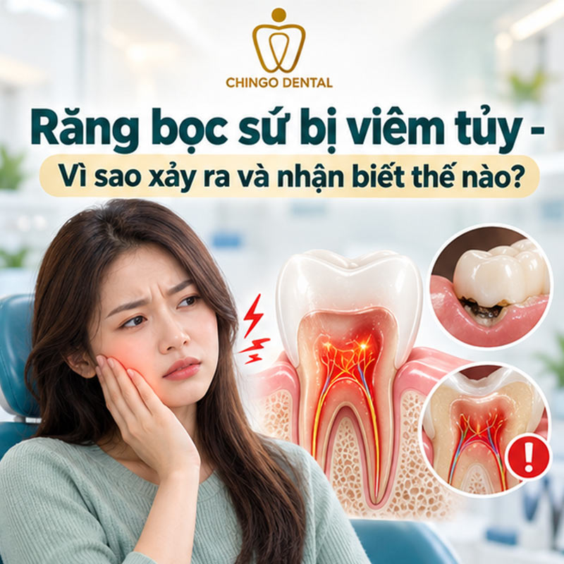 Bọc Răng Sứ Có Lấy Tủy Không? Giải Đáp Chi Tiết - Chingo Dental 2 bọc răng sứ có lấy tủy không