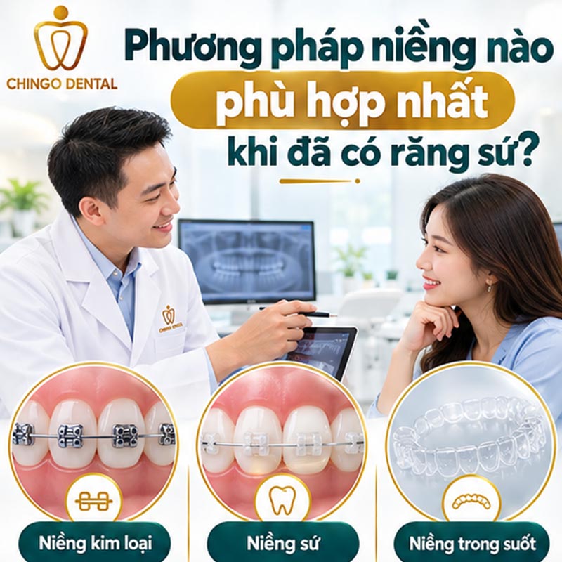 Răng Sứ Có Niềng Được Không? Giải Đáp Từ Chuyên Gia 3 bọc răng sứ có niềng được không