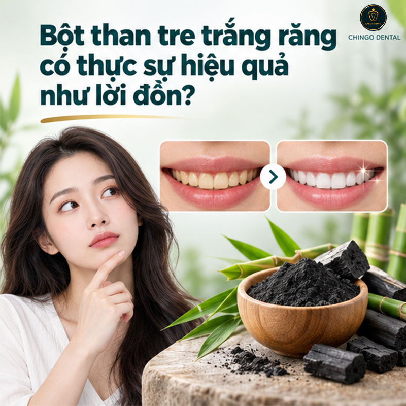 Bột Trắng Răng: Loại Nào Tốt, Dùng Thế Nào Cho Đúng Và Khi Nào Cần Đến Nha Khoa? 3 bột tẩy trắng răng