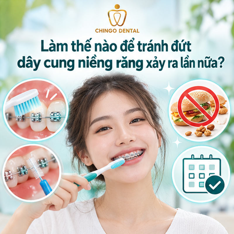 Đứt Dây Cung Niềng Răng: Nguyên Nhân, Cách Xử Lý Tạm Thời & Khi Nào Cần Gặp Bác Sĩ Ngay 4 bung mắc cài niềng răng
