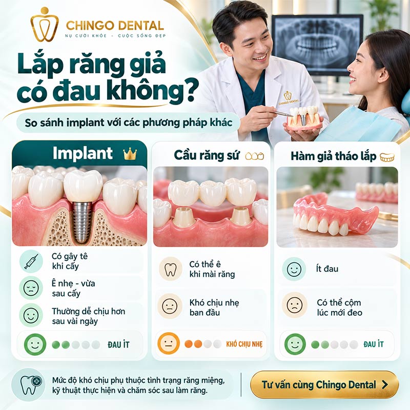 Trồng Răng Implant Có Đau Không? Giải Đáp Toàn Diện Từ A - Z 5 cắm implant có đau không