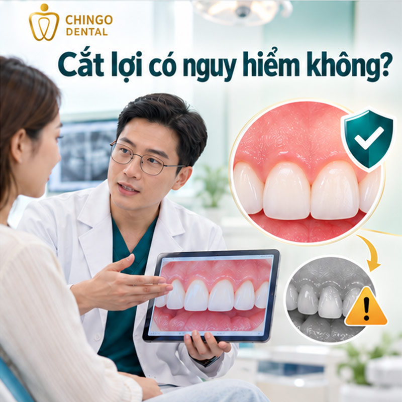 Cắt Lợi Có Đau Không? Giải Đáp Từ A - Z Cho Người Lần Đầu Thực Hiện 3 cắt lợi có đau không