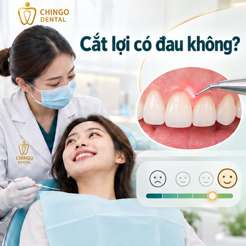 Cắt Lợi Có Đau Không? Giải Đáp Từ A - Z Cho Người Lần Đầu Thực Hiện 2 cắt nướu răng