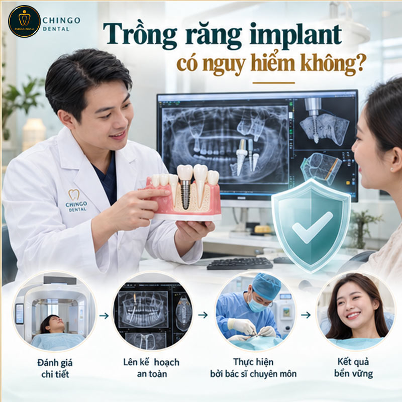 Trồng Răng Implant Có Đau Không? Giải Đáp Toàn Diện Từ A - Z 4 cấy implant có đau không