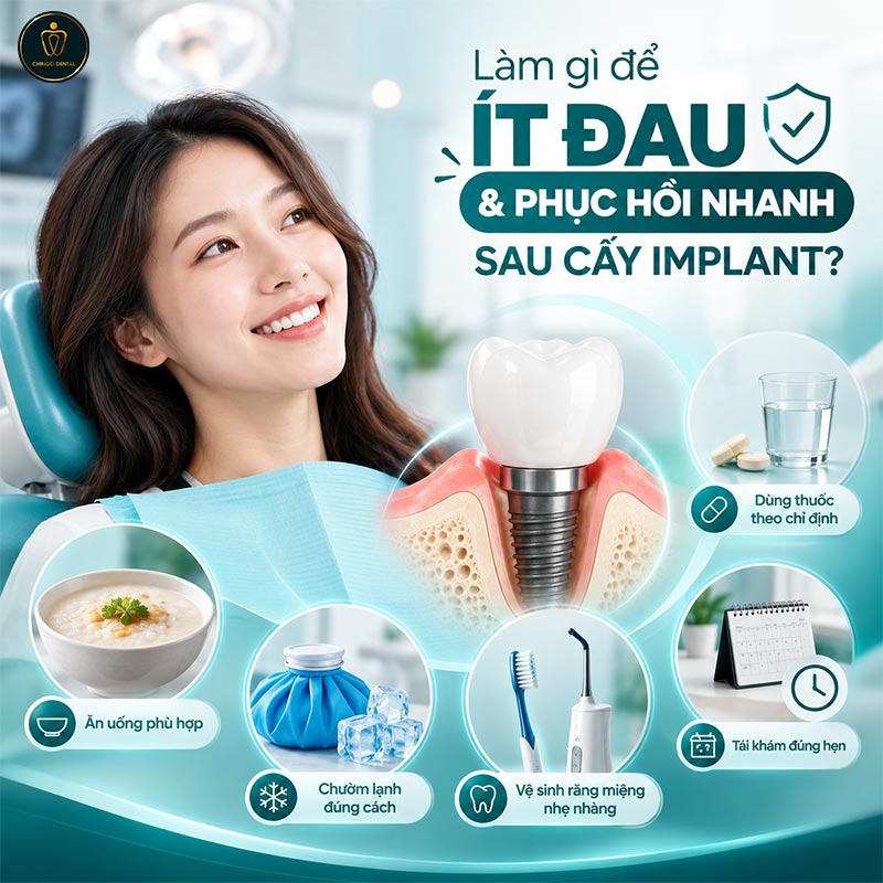 Trồng Răng Implant Có Đau Không? Giải Đáp Toàn Diện Từ A - Z 6 cấy răng implant có đau không